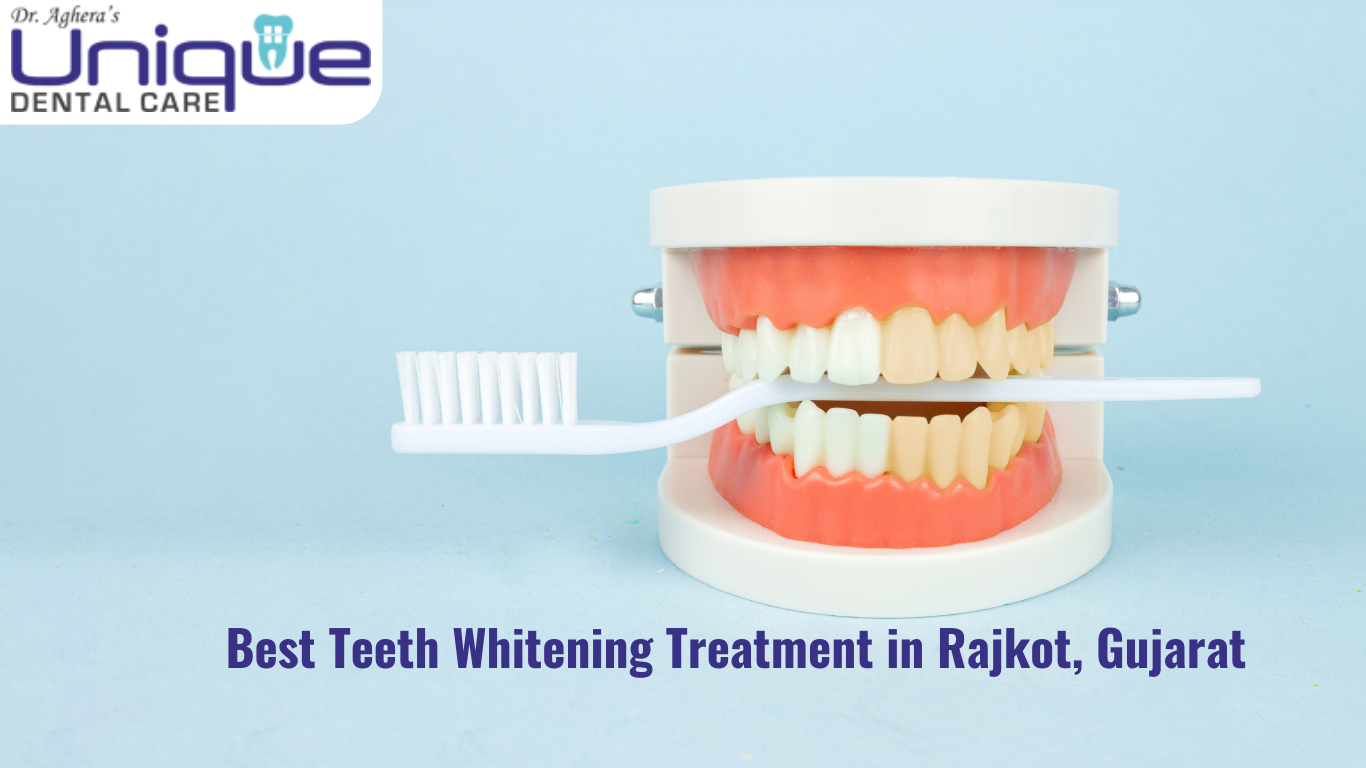 Best Teeth Whitening Treatment in Rajkot, Gujarat