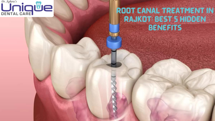 Root Canal Treatment in Rajkot: 5 Benefits You Didn't Know
