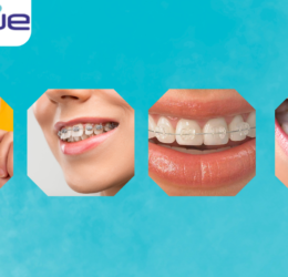 best orthodontic treatment in rajkot, gujarat