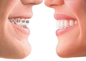 best orthodontic treatment in rajkot