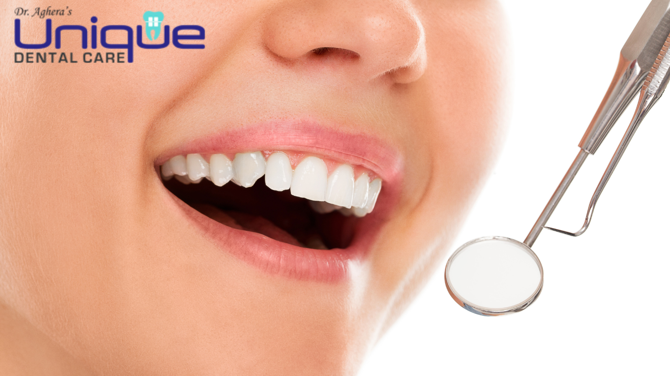 teeth whitening treatment in rajkot